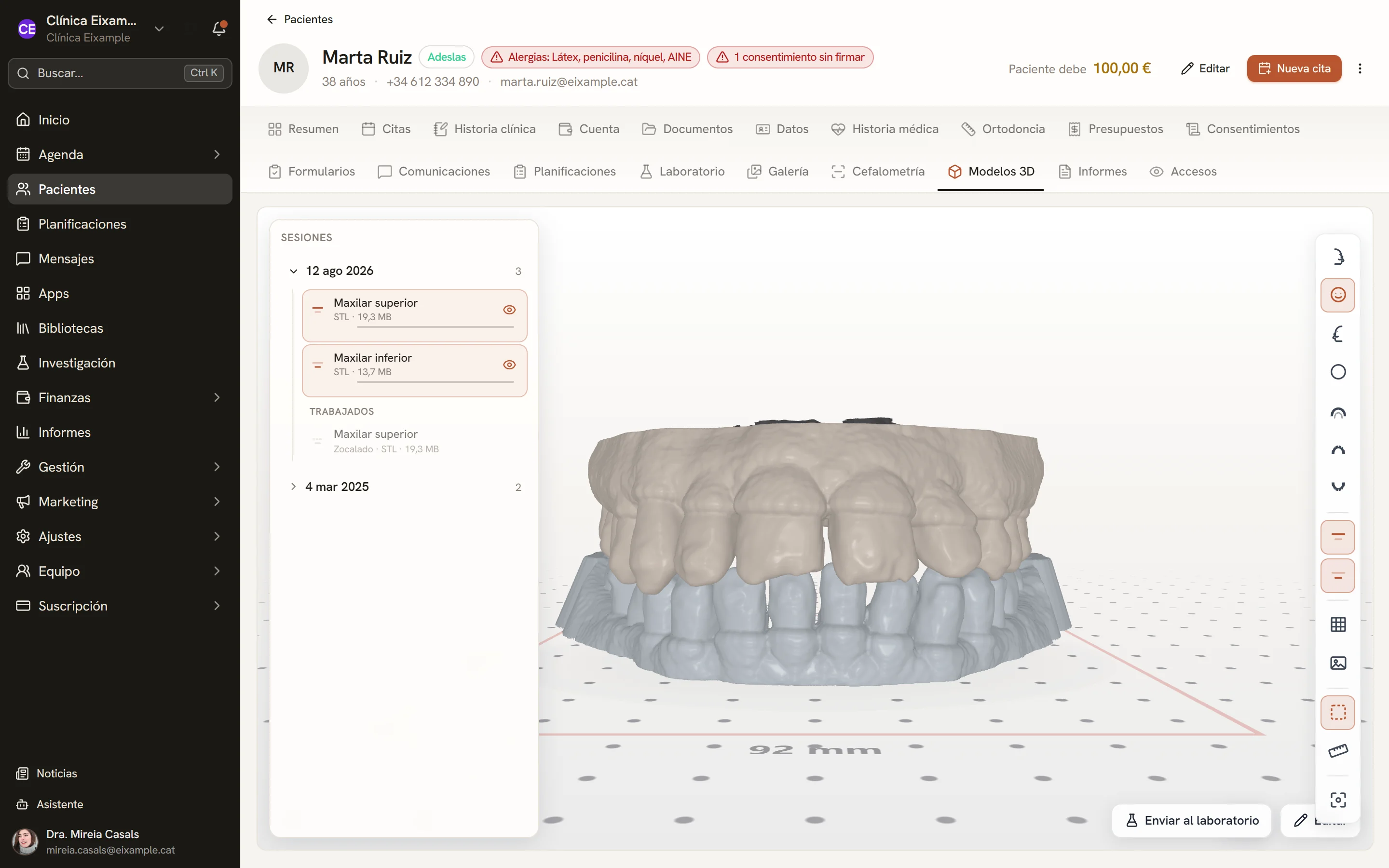 Visor 3D con las arcadas escaneadas de una paciente de muestra.